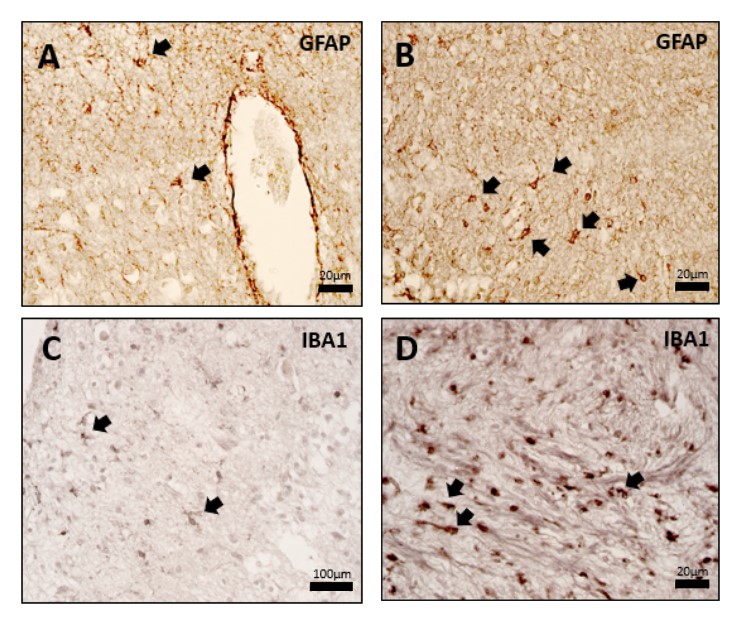 Figure showing immunohistochemical staining in the human olfactory bulb: (A) GFAP-positive vascular and non-vascular astrocytes in the inner layers of aged sample; (B) GFAP-positive astrocytes in the glomerular layer of young sample; (C) IBA1-positive microglia predominantly in the outer layers of young sample; and (D) increased IBA1-positive microglial expression in the glomerular layer of aged sample.