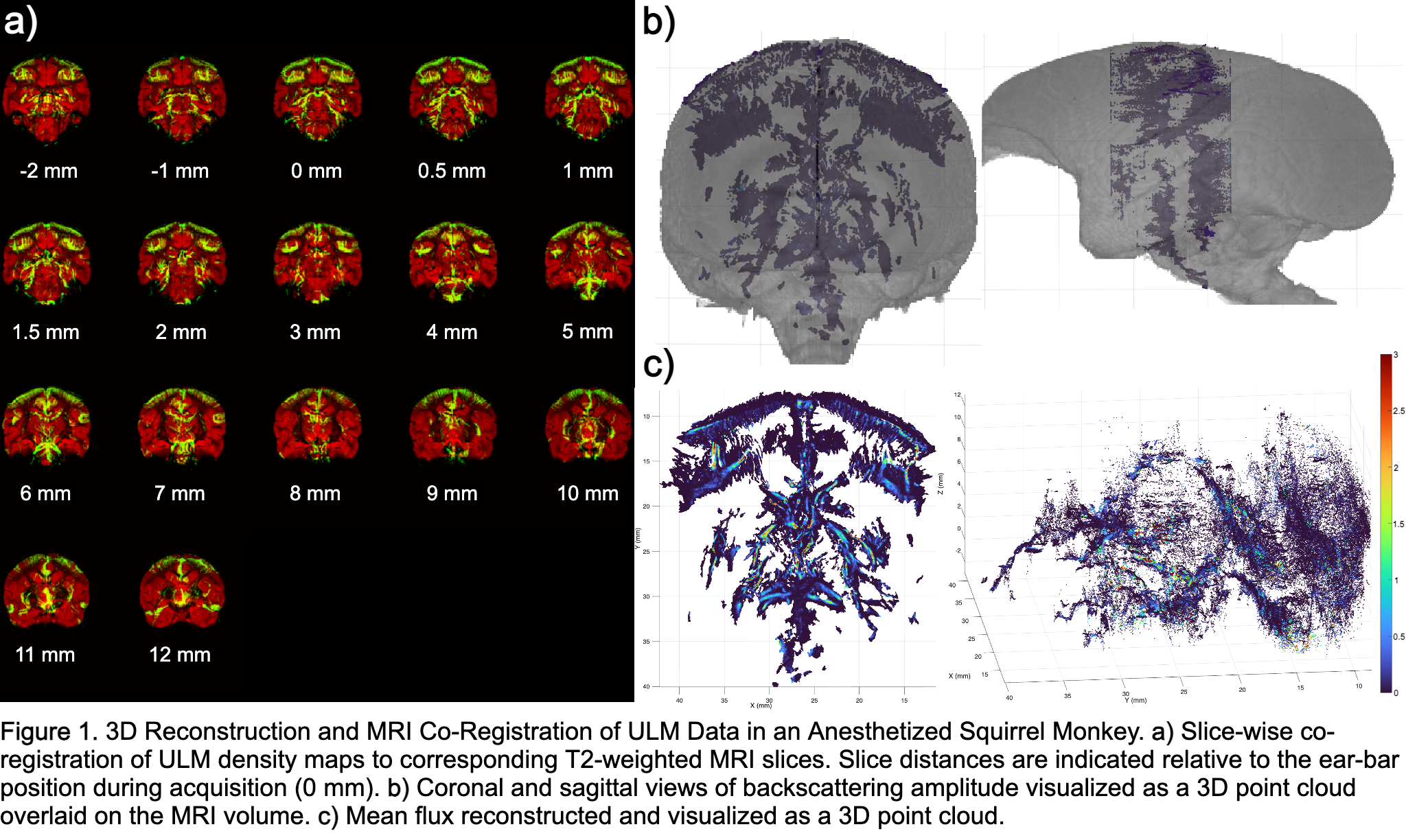 Three-panel figure of ULM data aligned to structural MRI in an anesthetized squirrel monkey. Panel a: coronal MRI slices in red with registered ULM density maps overlaid in green at different slice positions relative to the ear-bar plane. Panel b: semi-transparent 3D MRI with aligned backscattering amplitude point cloud inside. Panel c: 3D point cloud of mean vascular flux with color scale and no MRI.