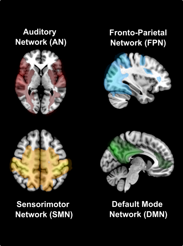 Figure 1 illustrates resting-state networks identified at baseline (T0) using independent component analysis. The left panel shows axial views of the Auditory Network and Sensorimotor Network. The right panel shows sagittal views of the Fronto-Parietal Network and the Default Mode Network.