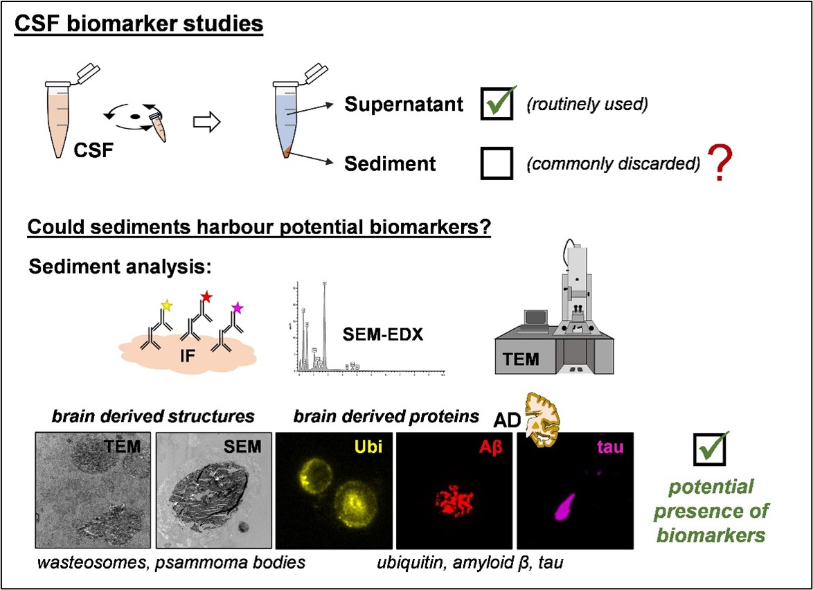 Summary illustration of the research question, methodologies used, representative results, and the main conclusion, highlighting the potential presence of biomarkers within cerebrospinal fluid sediments. AD: Alzheimer’s disease; CSF: cerebrospinal fluid; IF: immunofluorescence; SEM-EDX: scanning electron microscopy combined with energy-dispersive X-ray spectroscopy; TEM: transmission electron microscopy; Ubi: Ubiquitin protein; Aβ: amyloid-β protein; tau: tau protein. 