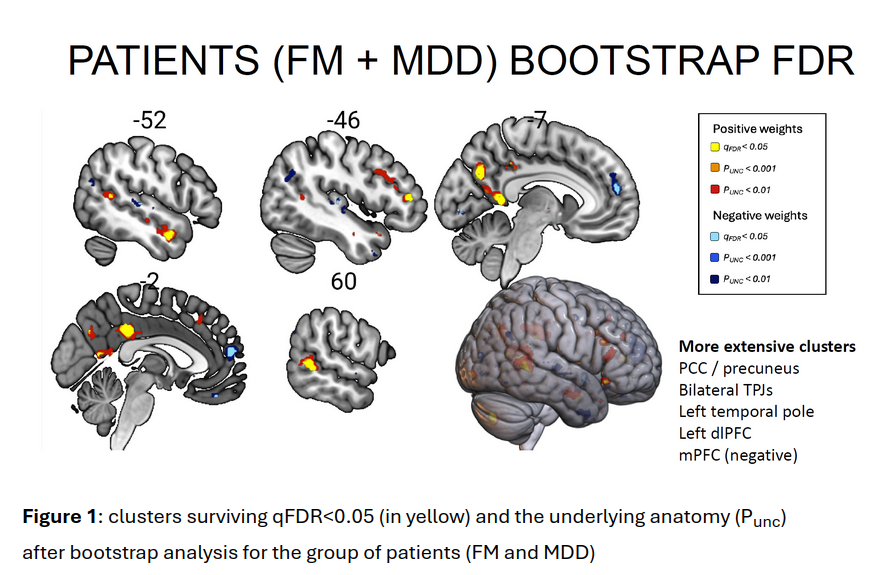 Neuroanatomical map of clusters surviving qFDR<0.05 and the underlying anatomy (uncorrected) after bootstrap analysis for the group of patients (FM and MDD)