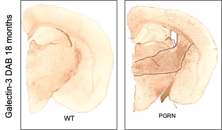 Representative coronal brain sections from 18-month-old mice immunostained for Galectin-3 (Gal-3). The left panel shows a wild-type (WT) mouse, displaying low and diffuse Gal-3 immunoreactivity across cortical and subcortical regions. In contrast, the right panel shows a progranulin-deficient (PGRN) mouse, with markedly increased Gal-3 staining, particularly in white matter tracts and cortical areas.