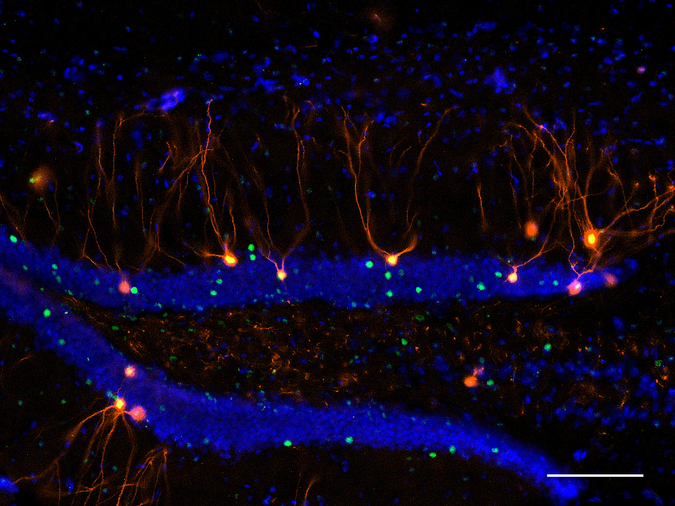 Fluorescence image of the dentate gyrus of the hippocampus in FosTRAP2:tdTomato mice showing engram neurons activated by the same experience (tdTomato, red) and reactivated during memory retrieval (c-Fos, green). Nuclei are labeled with DAPI (blue). White line indicates a 100 μm scale bar.
