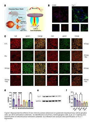 Figure1: Neuroprotective effects of low-intensity pulsed ultrasound on glutamate-injured primary retinal ganglion cells. (a) LIPUS stimulation schematic. (b) Identification of primary retinal ganglion cells. (c,d) JC-1 staining and quantification of mitochondrial membrane potential. (e,f) Western blot analysis and quantification of TUJ-1 expression.