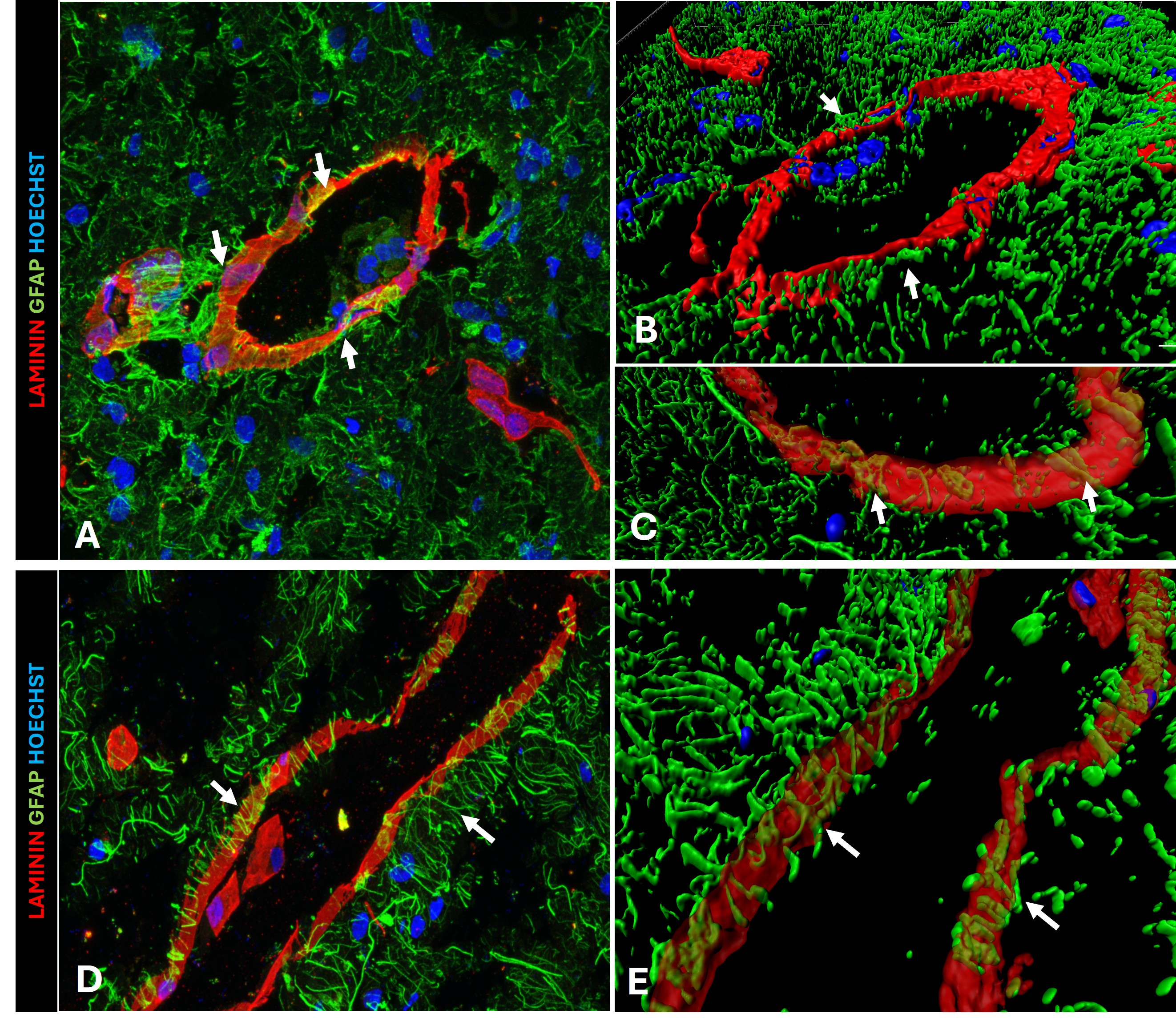 Image shows immunofluorescence analysis in human cerebellar tissue. A. Cross-section of a blood vessel. GFAP immunodetection (green) was used as an astrocyte marker, and Laminin immunodetection (red) was used to label the blood vessel basal lamina. Arrows indicate astrocytic processes extending to the basal lamina of blood vessels. B. 3D reconstruction of a vessel in cross-section. Astrocytic end-feet (green) contacting the vascular endothelium are indicated by a solid arrow (B-C). D. Longitudinal section of a blood vessel. Arrows indicate astrocytic processes extending to the basal lamina of blood vessels. E. Reconstruction of a longitudinal section of a blood vessel. Images were acquired at 63× magnification. Nuclei were stained with Hoechst
