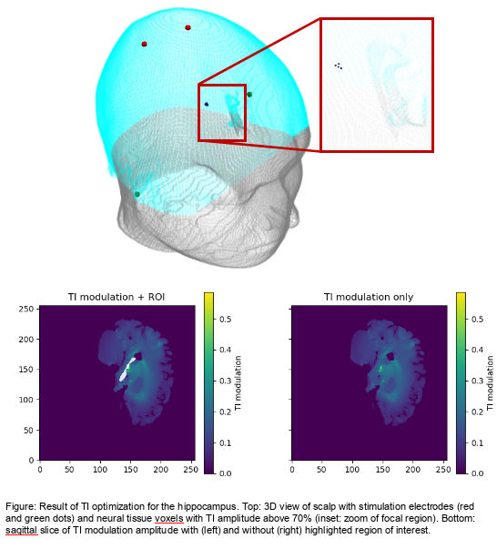 Result of Temporal Interference focusing