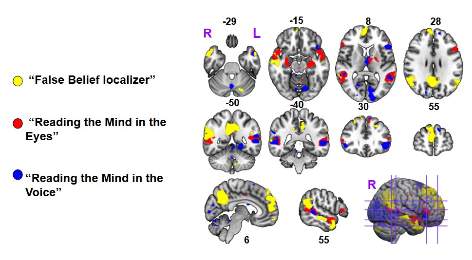 Visualization of activation in three tasks on the theory of mind 