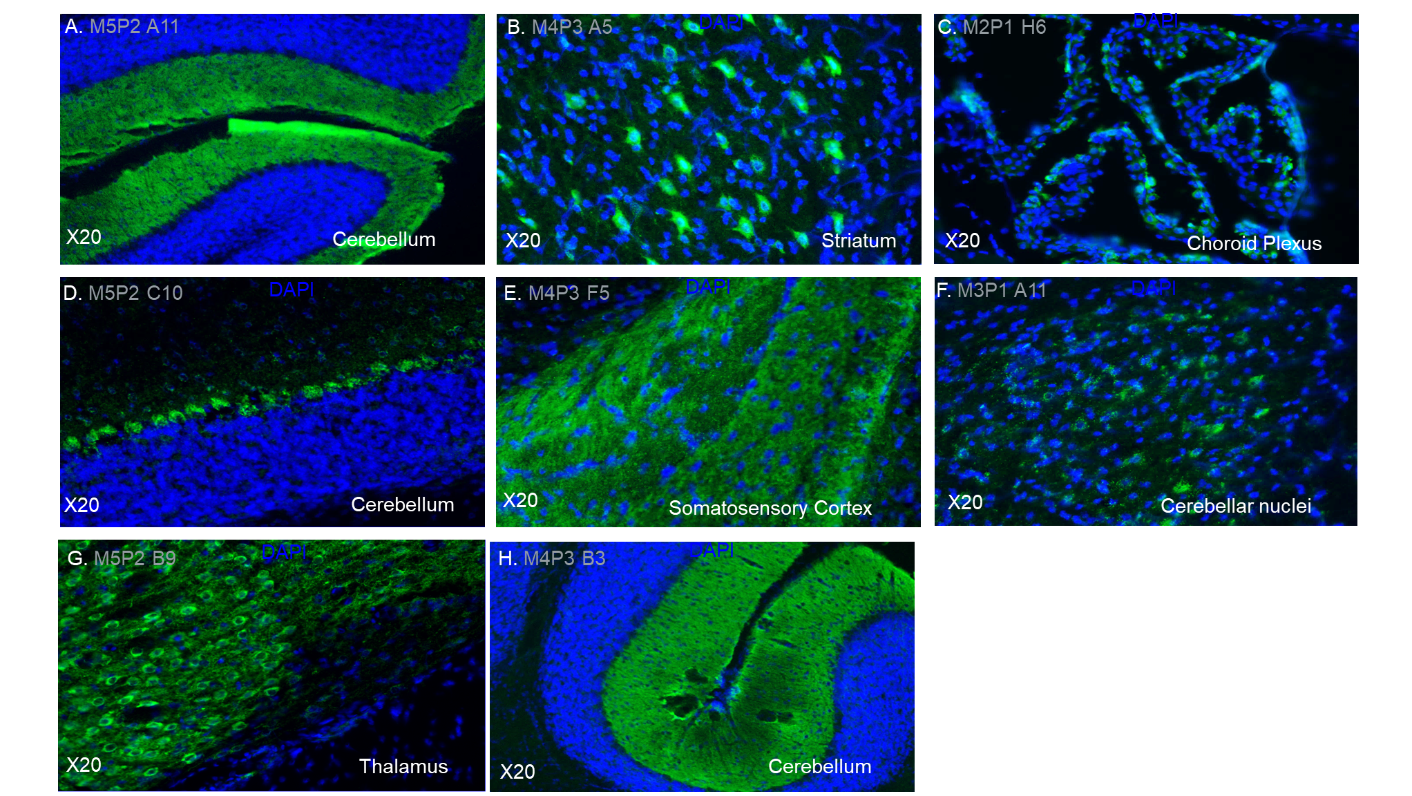 Figure 1.1: Reactivity of recombinant antibodies derived from post-stroke mice across different brain regions. The antibodies exhibit variable binding intensity in distinct areas of the brain sections.