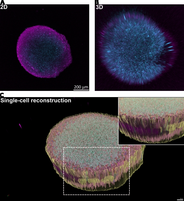 The figure depicts an image of a sodium arsenite treated spheroid, in 3 forms: Imaged in a 2D plane, a 3D plane, and a reconstructed render completed by our analysis software.