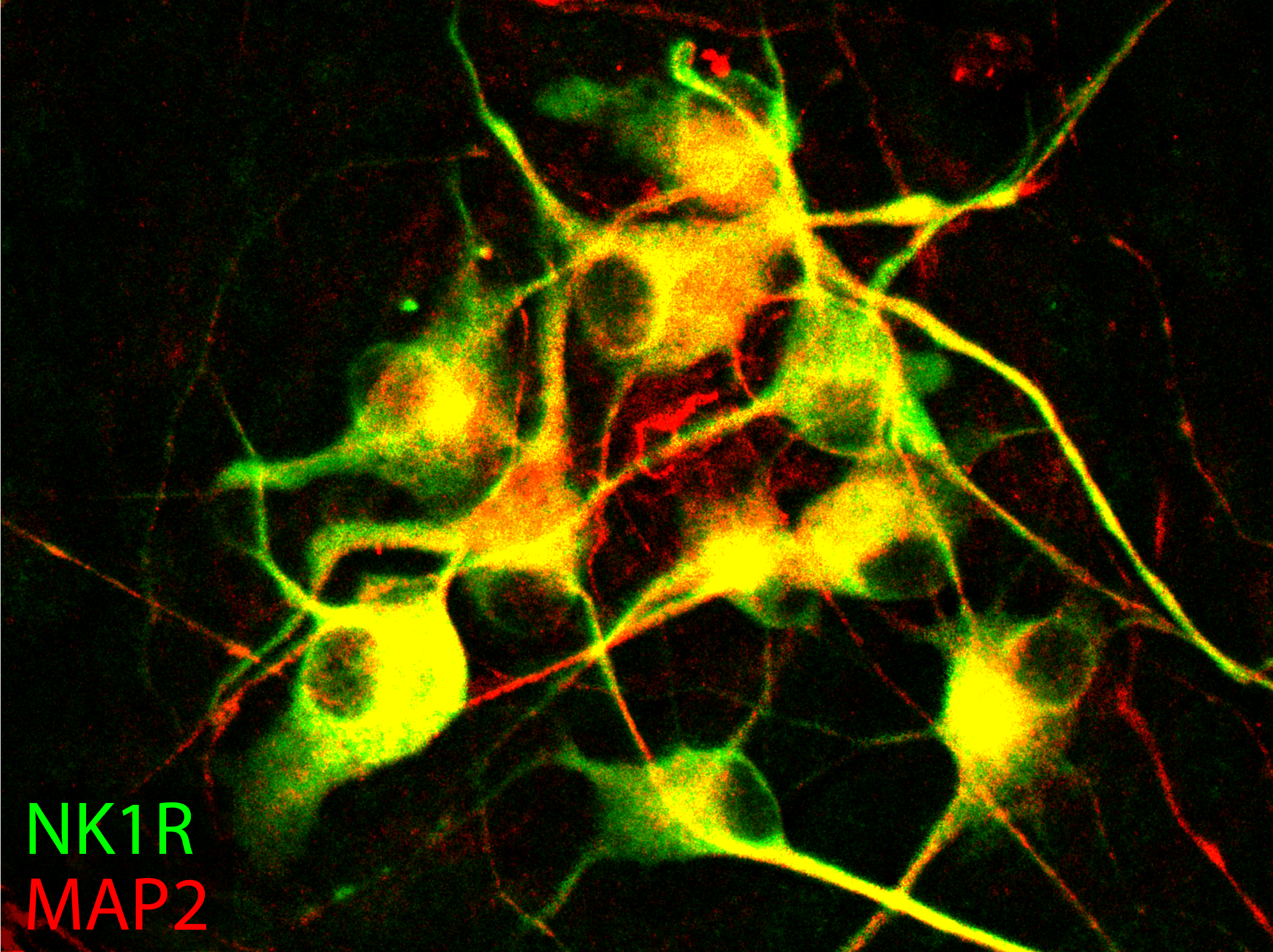 Immunofluorescent staining of 70day old neurons differentiated in vitro from human pluripotent stem cells, expressing NK1R (a marker of preBotC, green) and MAP2 (red).