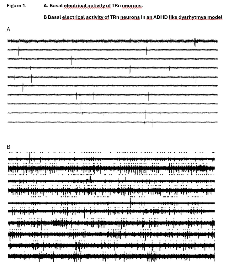 This image is divided into two sections. Section A describes 10 trials of basal electrical activity of TRn neurons, showing a low frecuency. Section B describes 10 trials of basal electrical activity in a 6-OHDA model, showing high frecuency.