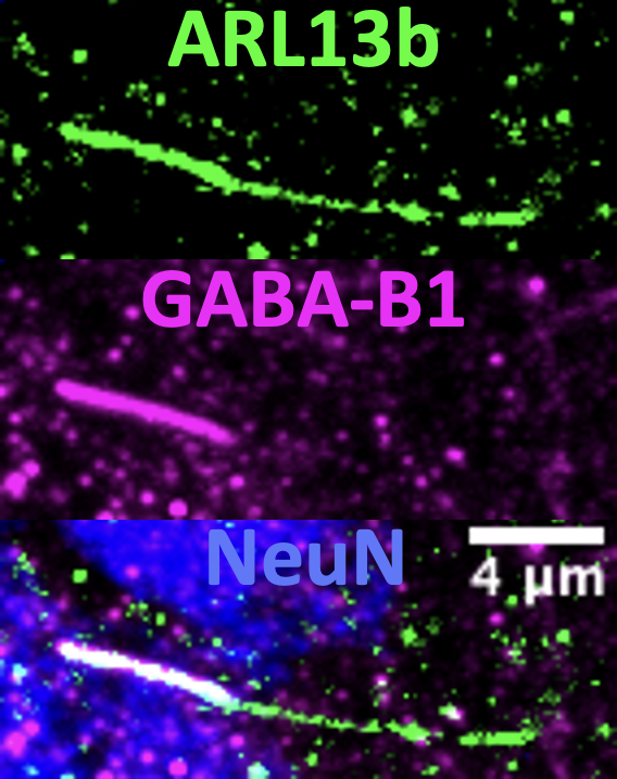 „Confocal image of mouse striatal brain section showing neurons, as detected by NeuN (blue), and one cilium marked with ARL13b (green). The proximal segment of the cilium is also positive for the metabotropic GABA-B1 receptor (magenta)“