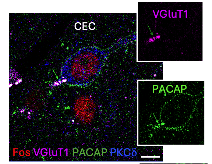 Early-activated PKCdelta-expressing neurons in the central amygdala, following acute hypotension, are surrounded by PACAP⁺/VGluT1⁺ calyceal terminals.