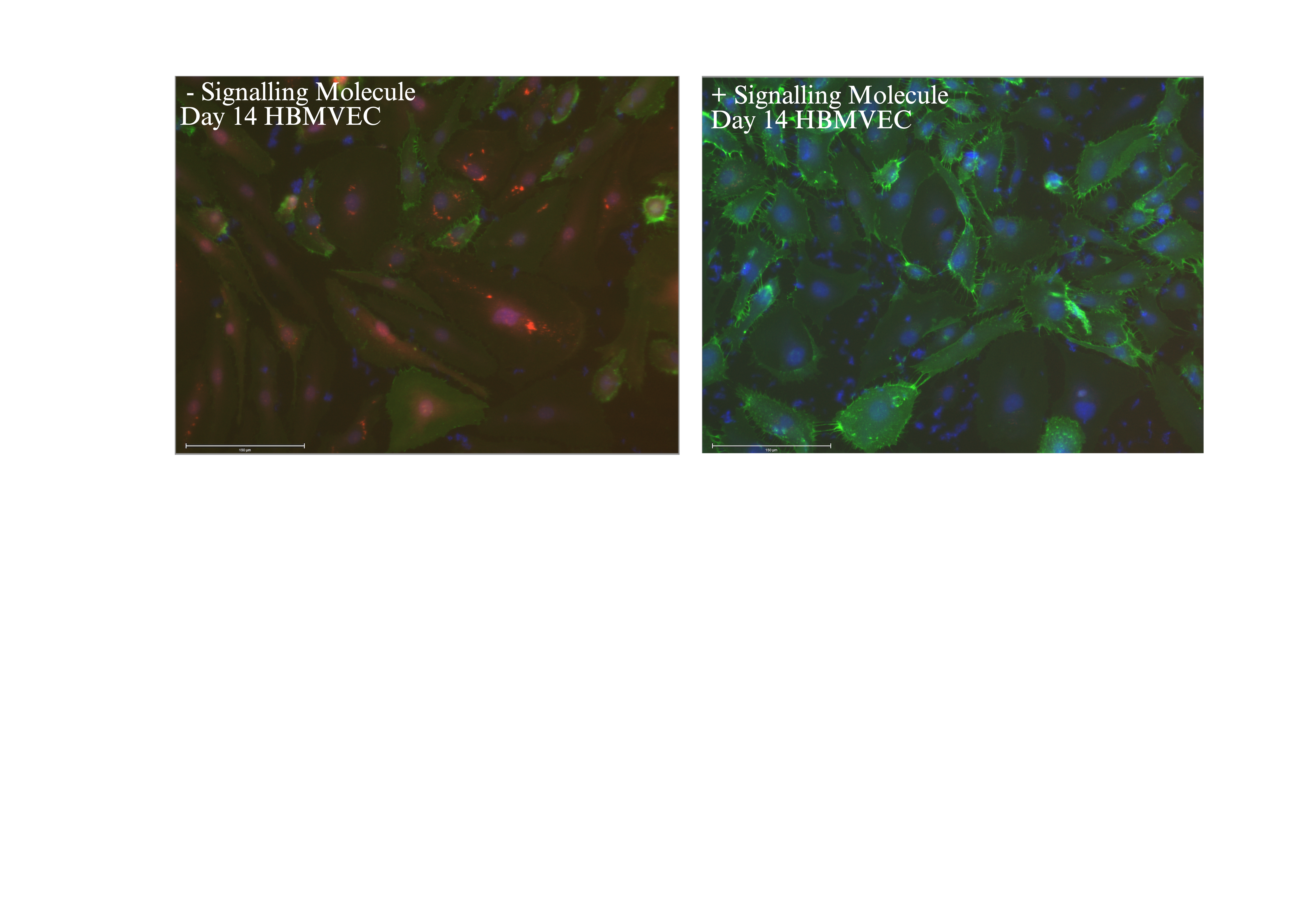 „alt text“Microscopic Image of ​Day 14 HBMVEC ​Cells with and without signalling molecule at 20x magnification. Staining for PDGFRB and CD31.