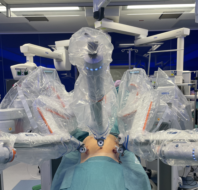 Op-Setup für Hugo-eTEP