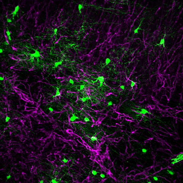 The image shows small, branched and bushy cells in green, which are the NG2 glial cells, amid the elongated processes of DCX+ migrating neurons