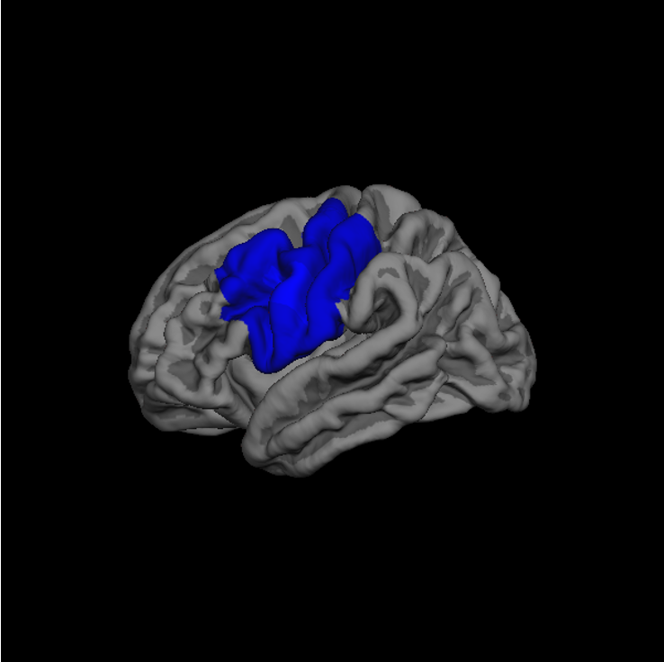 Significant decrease of the exponent in somatomotor and primary sensory regions of the left hemisphere following music listening in the stimulation condition compared to the no stimulation condition