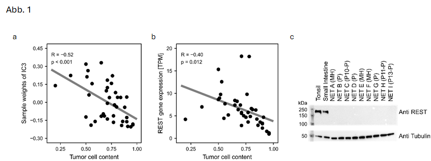 ICA3 korreliert mit dem Tumorzellgehalt und unterscheidet so Tumor von Normalgewebe (a). GSEA innerhalb dieser Komponente deckt REST als differenziell exprimiertes Gen auf und in der Tat korreliert REST negativ mit dem Tumorzellgehalt und ist daher im Tumor niedrig exprimiert (b). Western Blot Analysen konnten dies bestätigen (c).