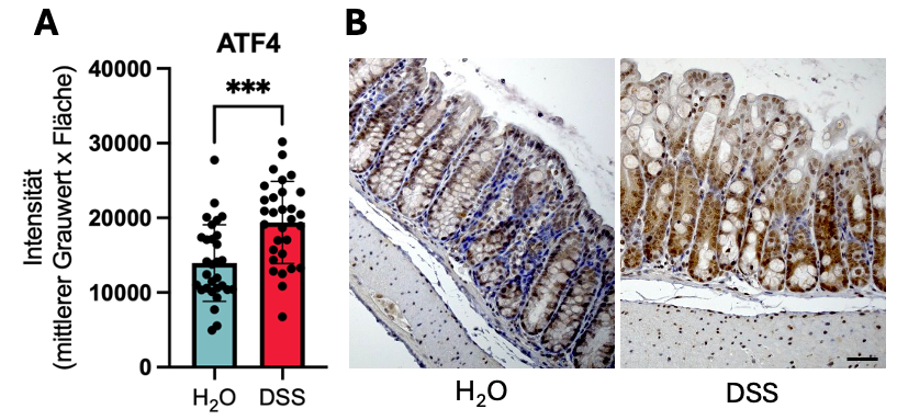 Abbildung 1 A) Quantifizierung ATF4-Immunhistofärbung Kolon in ImageJ (n=3 WT-Mäuse, 2,5 % DSS oder H₂O für 5 d). B) Repräsentative Bilder, Maßstab = 80 µm. Statistik: Student’s t-Test, *** = p < 0,001.