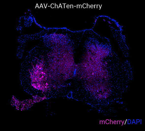 Lumbar spinal cord section showing magenta motor neurons and root axons with blue nuclei