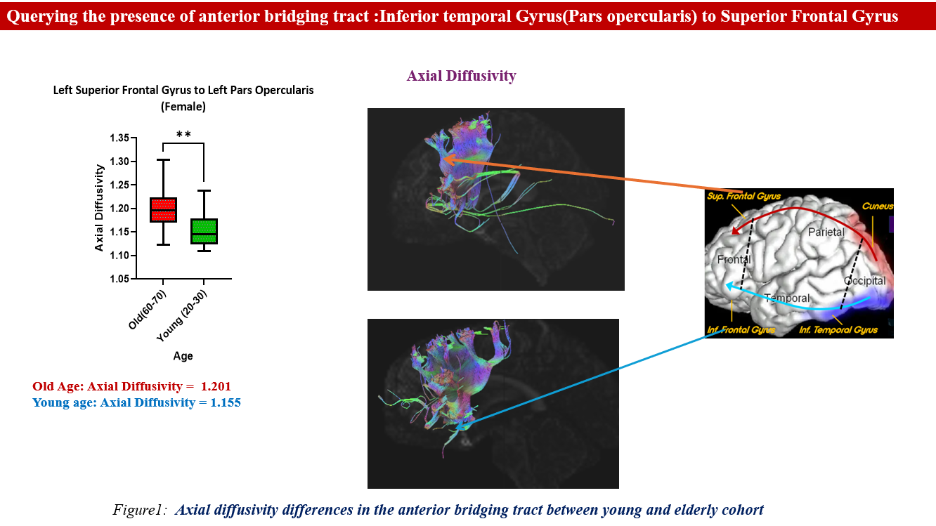 Diffusion MRI tractography showing the anterior bridging tract connecting the inferior temporal gyrus and superior frontal gyrus, with comparison of axial diffusivity between young and elderly cohorts illustrated by a box plot and brain maps.