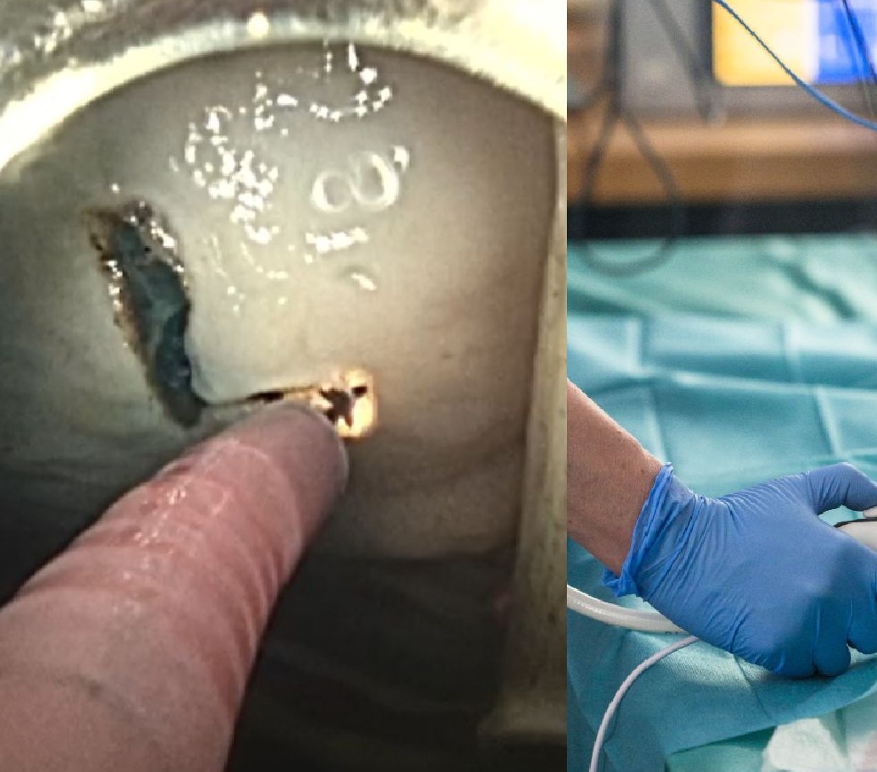 Abbildung 3: ESD mit dem steuerbaren ESD-Messer im Schweinemagenmodell im Rahmen einer Machbarkeitsstudie