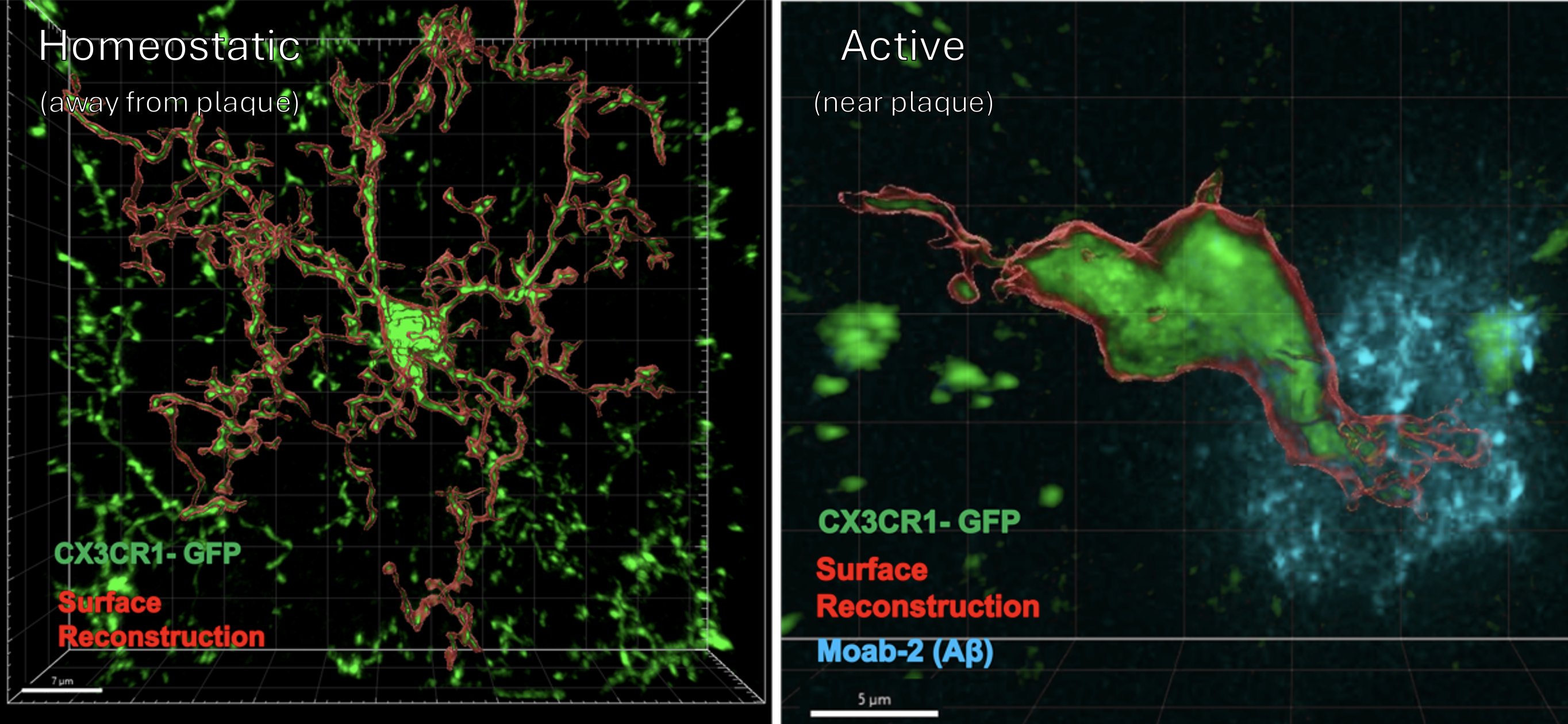Figure depicting homeostatic microglia (away from plaque) versus active microglia (near plaque). Homeostatic microglia appear highly branched, while active microglia have a more spherical, ameboid shape.