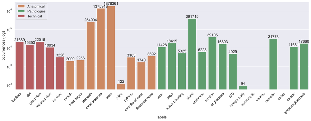 Abbildung 1: Verteilung der Annotationen im Galar-Datensatz über technische, anatomische und pathologische Kategorien. Die Grafik zeigt die Häufigkeit der vergebenen Labels. [1]