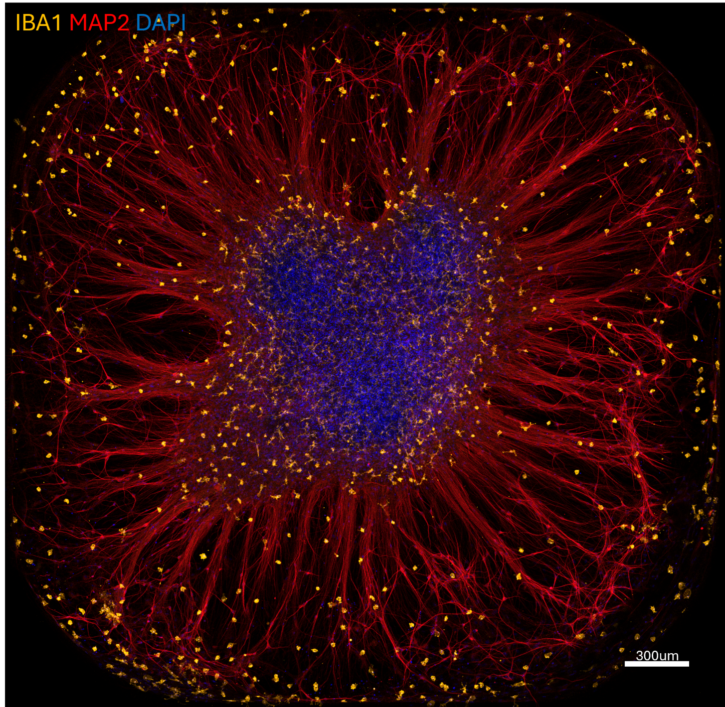 ALT TEXT: IBA1+ Microglia distributed across an adherent cortical organoid stained for dendrites (MAP2) and nuclei (DAPI).