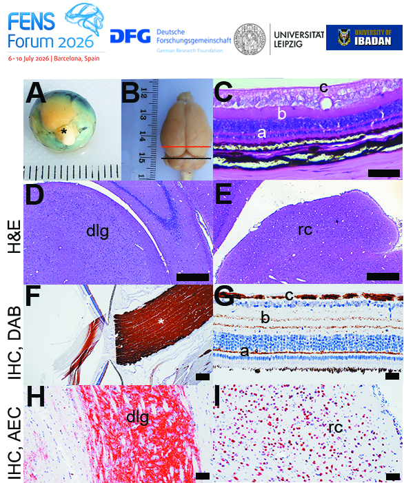 Composite figure showing the visual pathway of the African tree squirrel. Gross images depict the eyeball with optic nerve and the brain with marked sectioning levels. Histological sections show the layered retina, dorsal lateral geniculate nucleus, and rostral colliculus. Immunohistochemical panels illustrate myelinated axon bundles in the optic nerve, stratified axonal organization in the retina, synapse-rich organization in the dorsal lateral geniculate nucleus, and dense neuronal populations in the rostral colliculus.