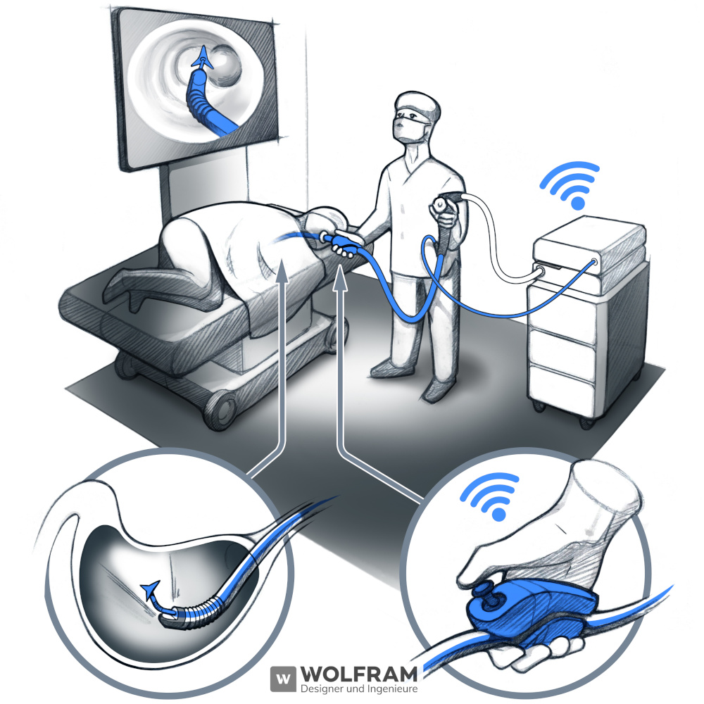 Abbildung 1: Ein-Personen-Bedienung des steuerbaren ESD-Messers
