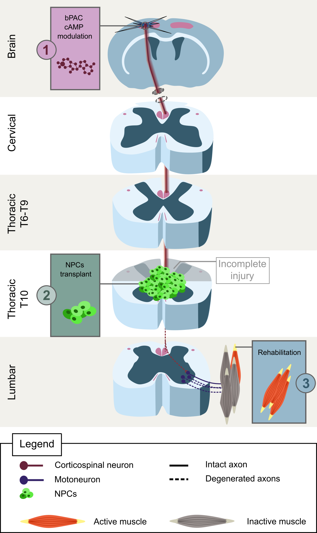 In the illustrated experimental paradigm, recovery is promoted through a combinatorial strategy targeting both intrinsic neuronal growth capacity and extrinsic support at the lesion site. First, corticospinal neurons in the motor cortex are intrinsically stimulated through optogenetic activation of bPAC, enabling activity-dependent elevation of intracellular cAMP levels to enhance axonal growth potential. Descending corticospinal tract axons project toward the thoracic spinal cord, where an incomplete injury interrupts signal transmission. At the injury epicenter (T6–T9), neural progenitor cells (NPCs) are transplanted to provide a permissive cellular substrate that supports axonal regeneration and tissue integration. Regenerating and spared fibers extend beyond the lesion and engage downstream spinal circuits, including lumbar motor networks. Finally, task-specific rehabilitation is applied to reinforce functional connectivity between regenerated pathways and target muscles