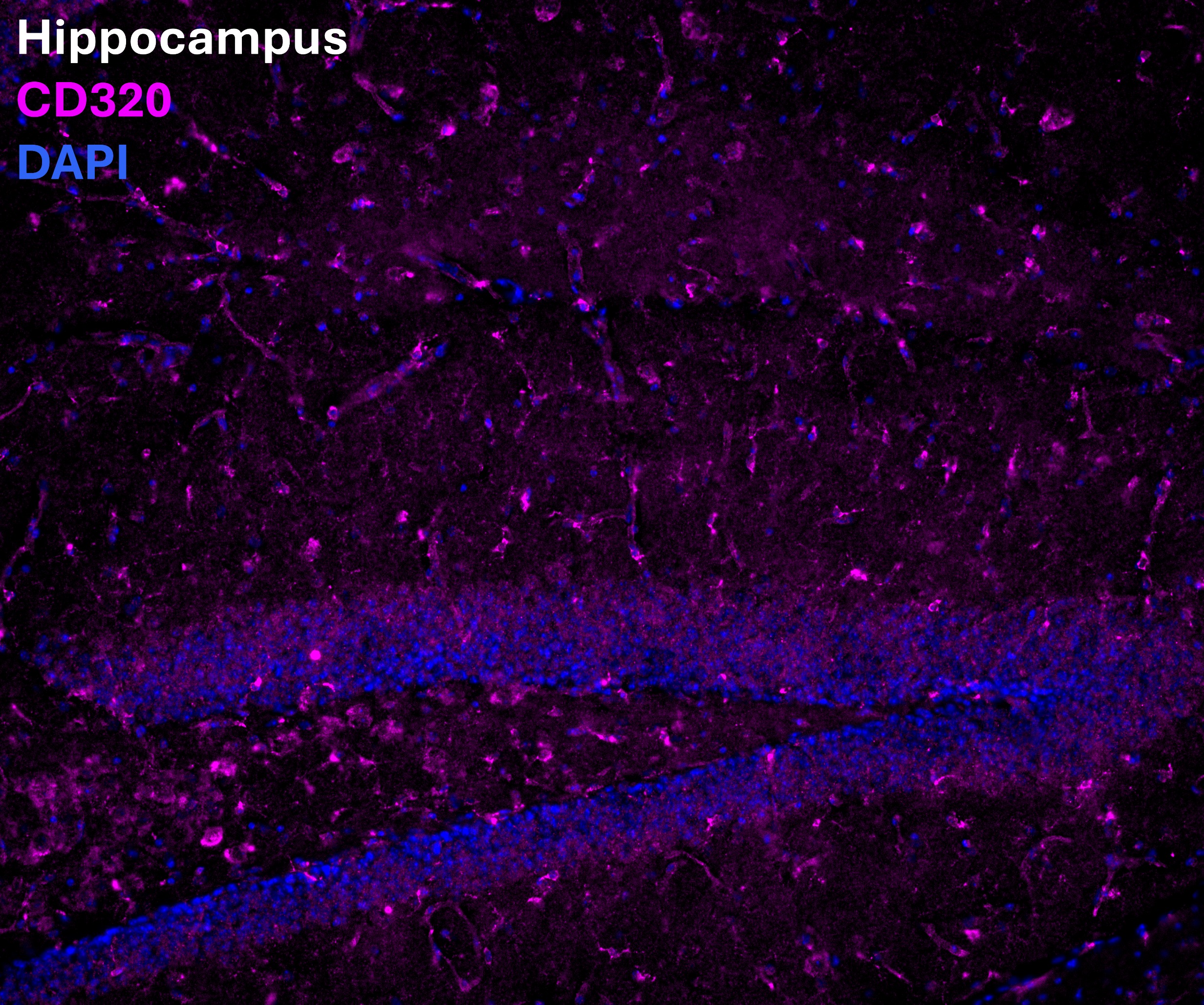 The image shows expression of the transcobalamin receptor (CD320) in the hippocampus of an adult mouse (magenta), costained with DAPI (blue).