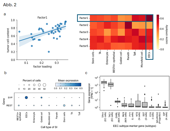 Mittels NMF wurde der Faktor 1 identifiziert, der mit dem Tumorzellgehalt korreliert. Die Genexpression innerhalb dieses Faktors hat starke Ähnlichkeit mit der von enteroendokrinen Zellen (EECs), daher können diese als Ursprungszelle von dNETs angesehen werden (a). REST ist bereits in EECs wenig exprimiert (b). Die Expressionsanalyse von Markergenen der EEC Subtypen zeigt eine starke Expression der Markergene von enterochromaffinen Tellen (ECCs) im dNET Gewebe, sodass der EEC Subtyp der ECCs als Ursprungszelle von dNETs gewertet werden kann.