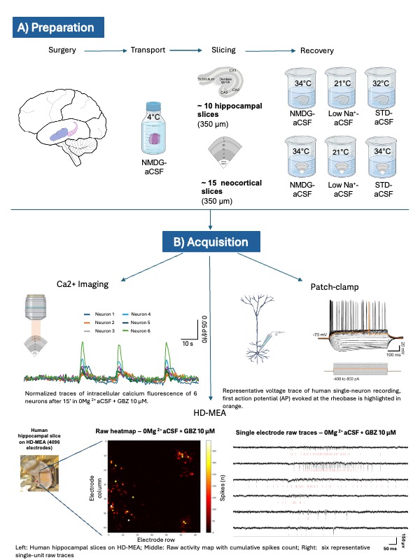 A) Expermential pipeline set up un our laboratory for collection, transport, slicing, recovery of human brain slices. B) Schematic representation of techniques employed in our lab for functional multimodal characterization of ex-vivo human brain slices