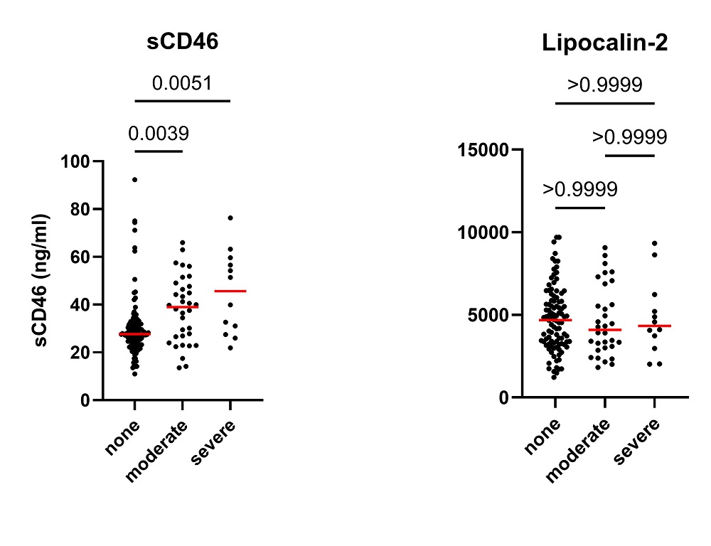 sCD46 levels in verschiedenen Steatose-graden bei Leberlebendspendern gegen Lipocalin-2 levels in verschiedenen steatosegraden in den selben Patienten. sCD46 stellt die verschiedenen Steatosegrade korrekt dar, Lipocalin-2 nicht.