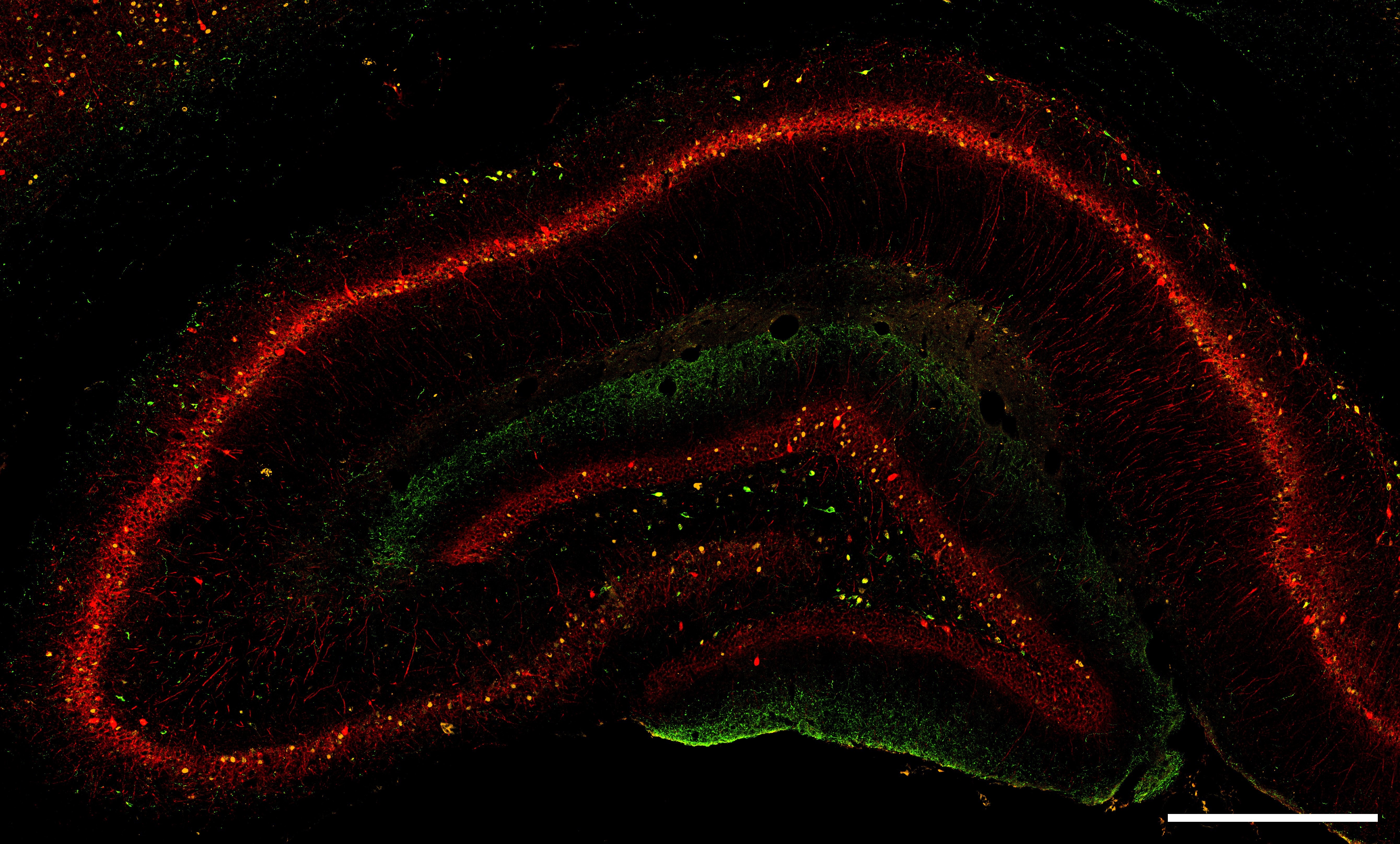 Confocal microscopy image of the rat hippocampus with immunoreactivity for parvalbumin (red), somatostatin (green), and cFos (yellow). Scale bar: 500 µm