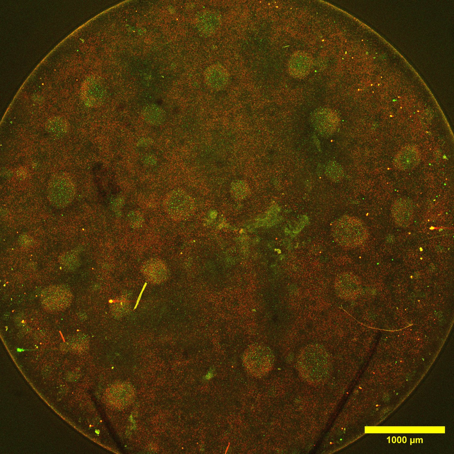 Immunofluorescence image for PAX6 (anterior neural marker), 488 green, SIX3 (TF in eye/forebrain development), 568 red channels at day 3 (NIM only) at x2.5 magnification. There is uniform expression of SIX3 and PAX6 in both the 2D monolayer and the 3D spots.