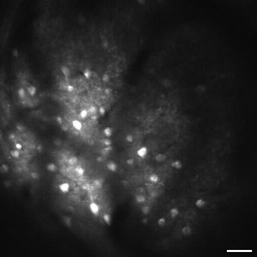 Fig1: Mini2P image of GCamp6s labelled neurons. Scale Bar 50µm