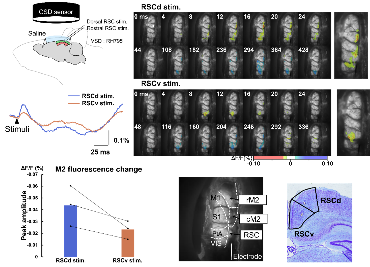 Schematic of the imaging experiment. Cortical responses evoked by stimulation of the dorsal and ventral retrosplenial cortex (RSC) are displayed in a time-resolved manner, illustrating differences in spatiotemporal activation patterns. A graph compares fluorescence signal changes in the secondary motor cortex (M2) following dorsal versus ventral RSC stimulation. Localisation of the electrical stimulation site is confirmed by Nissl-stained histological images.