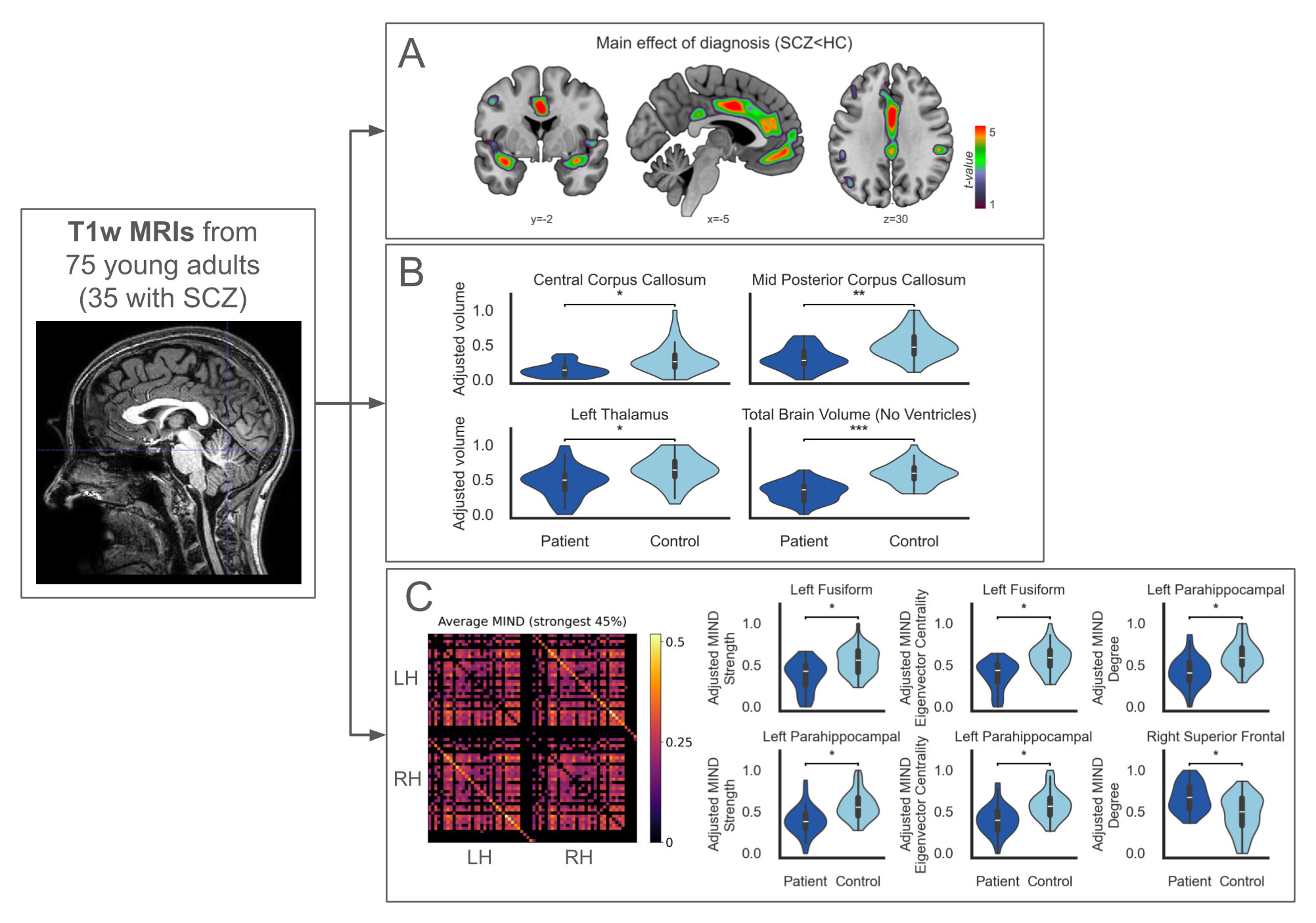One box (with structural MRI data) is connected with arrows to three boxes (A, B, C) which contain plots with the main results from respectively the VBM, Freesurfer and MIND analyses.