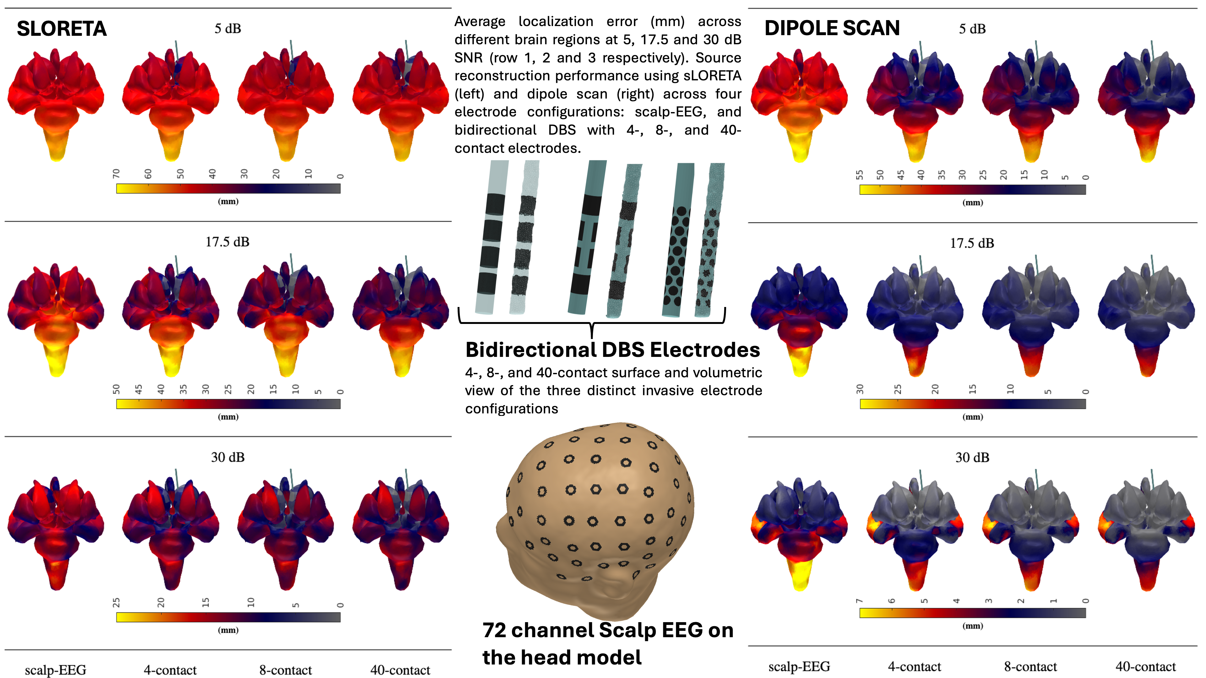 Three-dimensional brain maps comparing source localization error using sLORETA and dipole scan at 5, 17.5, and 30 dB SNR for scalp EEG and DBS electrodes with 4, 8, and 40 contacts. Central panels show DBS lead designs and a 72-channel EEG cap.