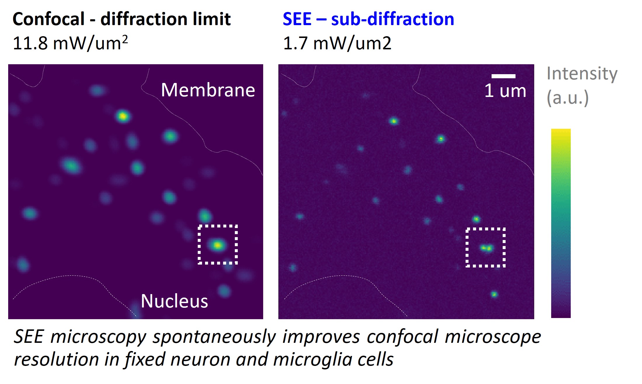 On the left, a confocal image of upconversion nanoparticles endocytozed in a neural cell is taken at 11.8 mW per um2 and shows resolution at the diffraction limit, as expected. Simply reducing the laser power to 1.7mW per um2 pushes the system in super-linear regime, spontaneously improving the resolution more than twice over the diffraction limit in the same confocal microscope - shown on the right. 